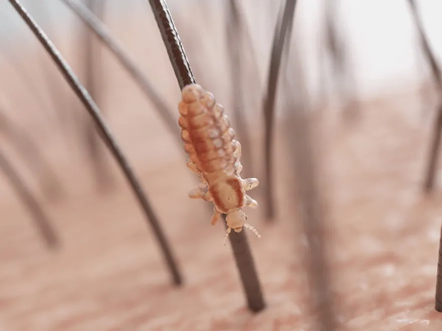 Mơ Thấy Chấy Đầy Đầu